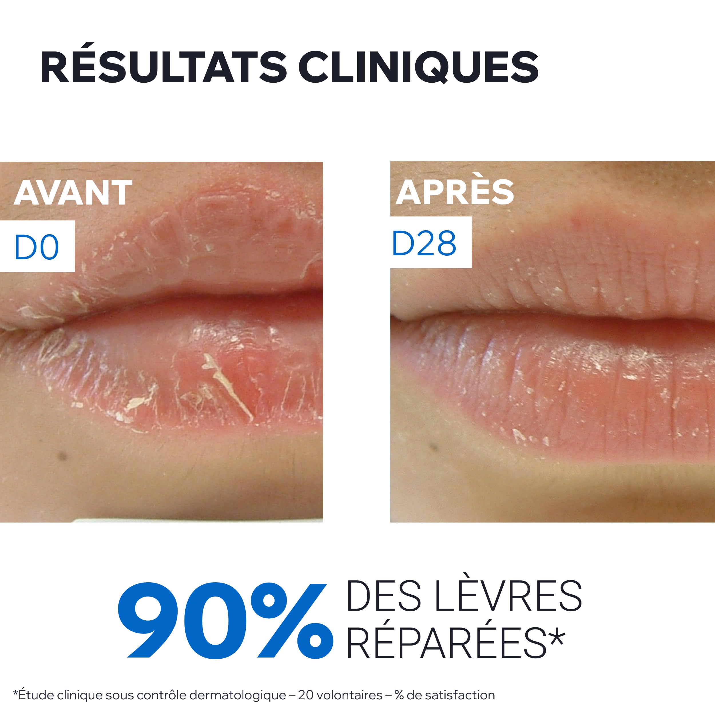uriage-bari-derm-cica-baume-l-vres-protecteur-15ml image 6