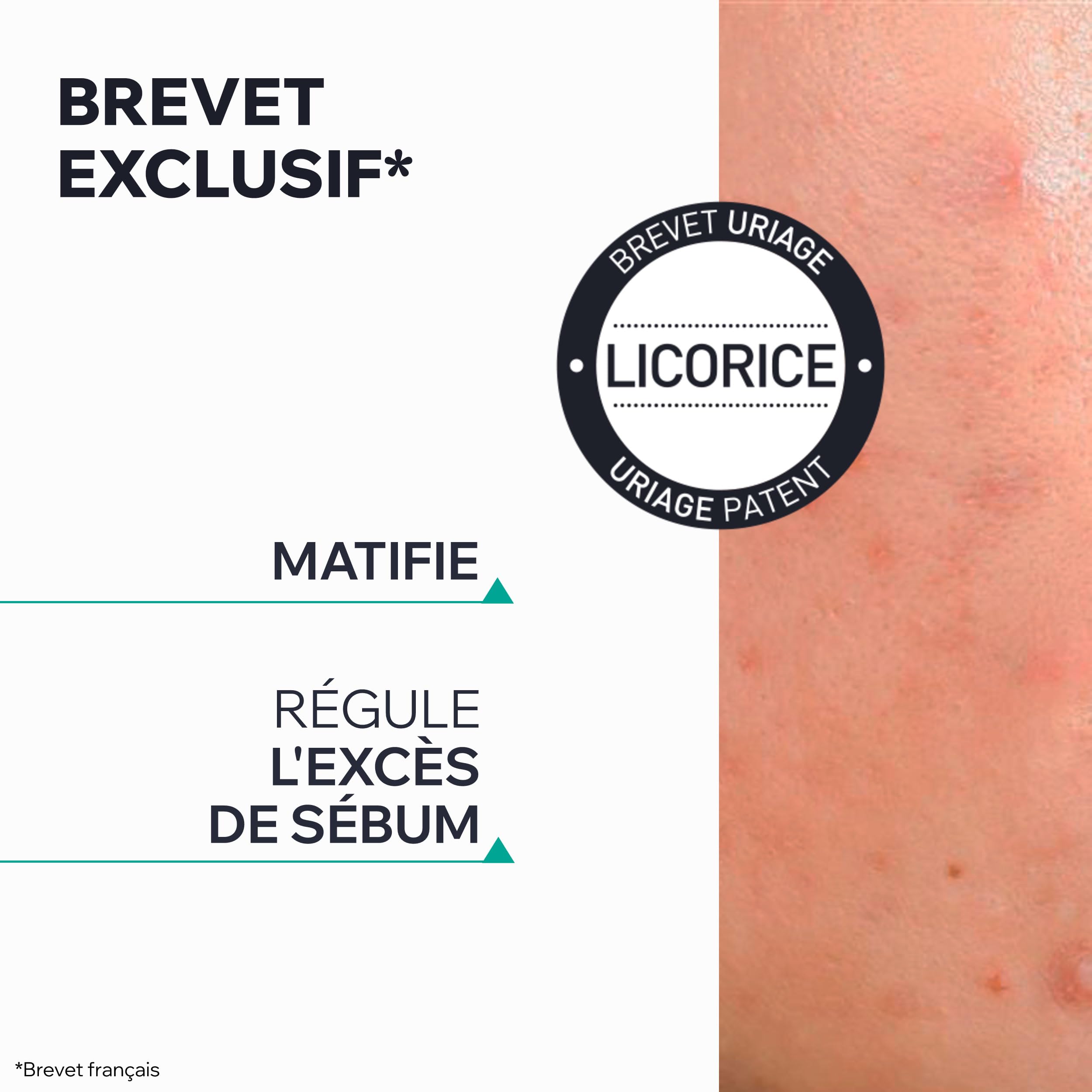 uriage-hys-ac-p-te-sos-boutons-15g-argile-verte-zinc-arbre-th image 5