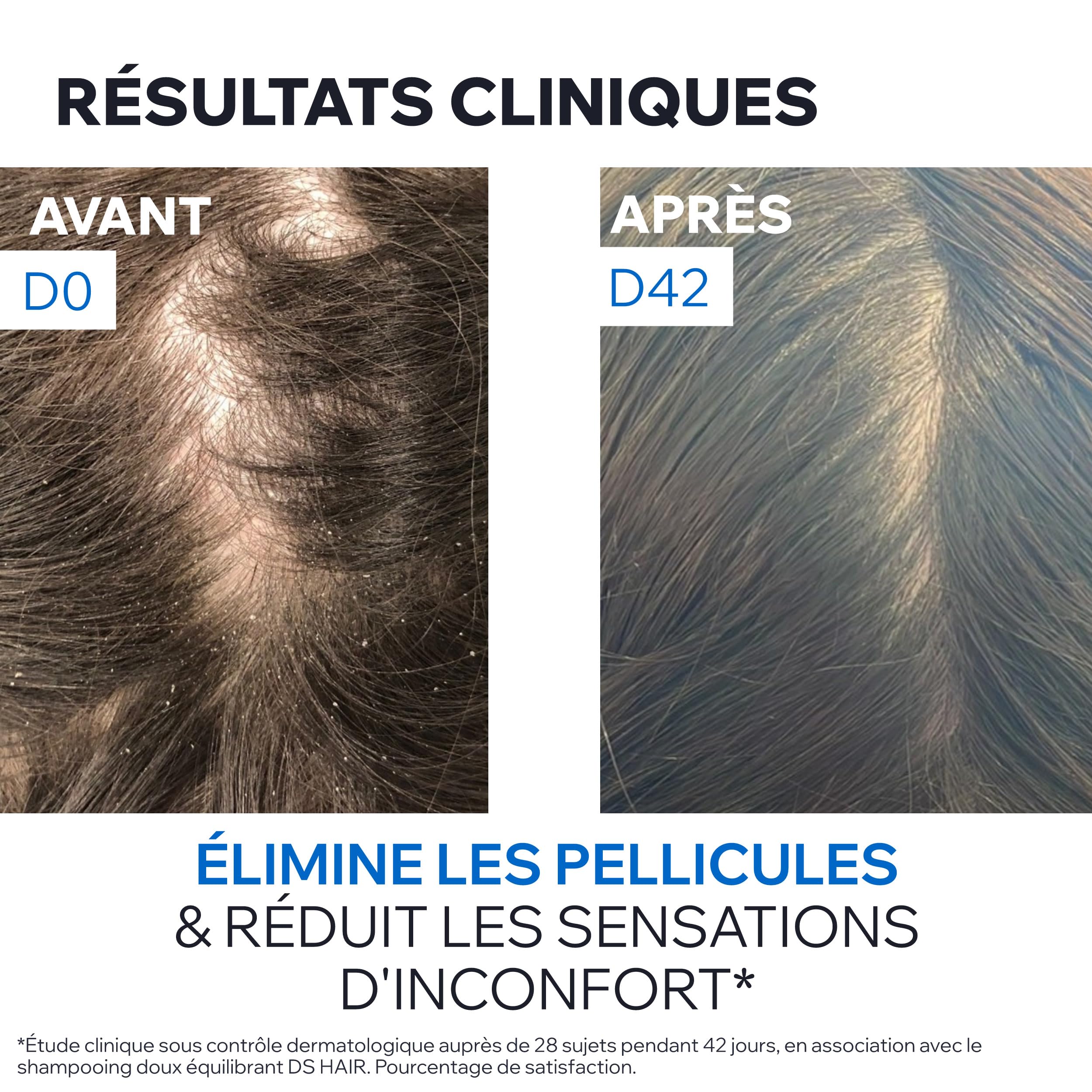 uriage-ds-hair-shampooing-traitant-antipelliculaire-200ml image 7