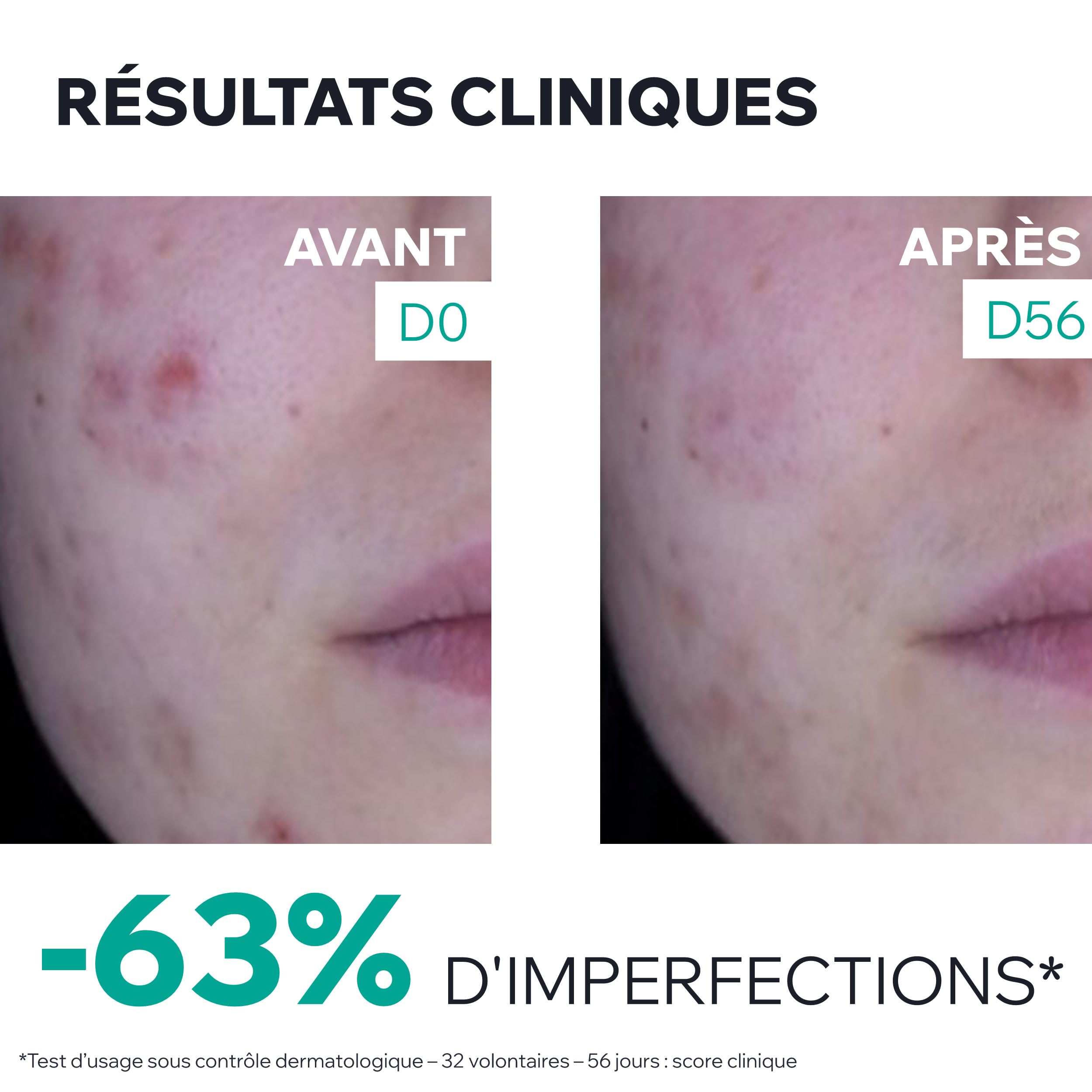 uriage-hys-ac-3-regul-soin-global-anti-imperfections-40-ml image 6