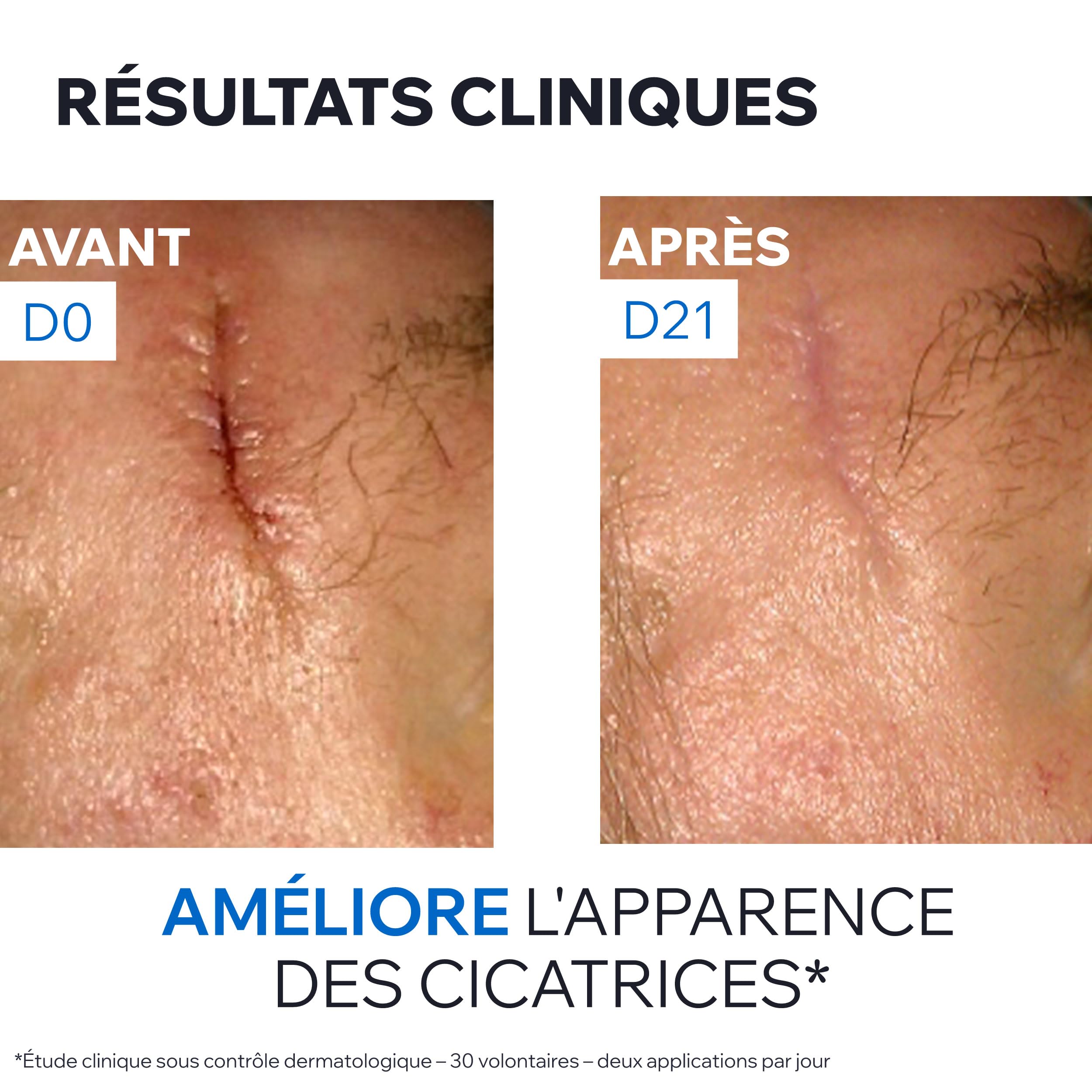 uriage-bari-derm-cica-cr-me-r-paratrice-cuivre-zinc-40ml image 6