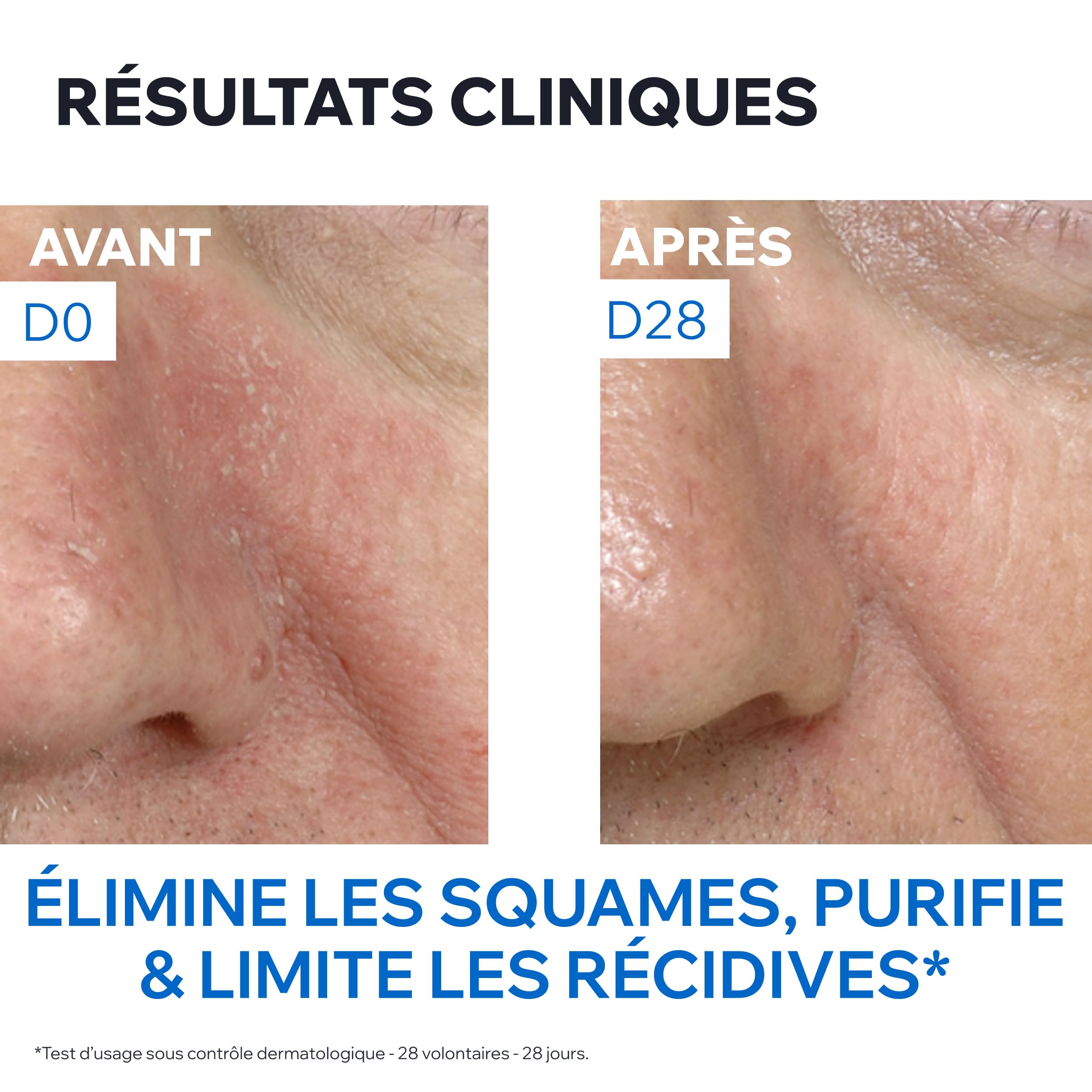 uriage-ds-mulsion-apaisante-r-gulatrice-40ml image 6