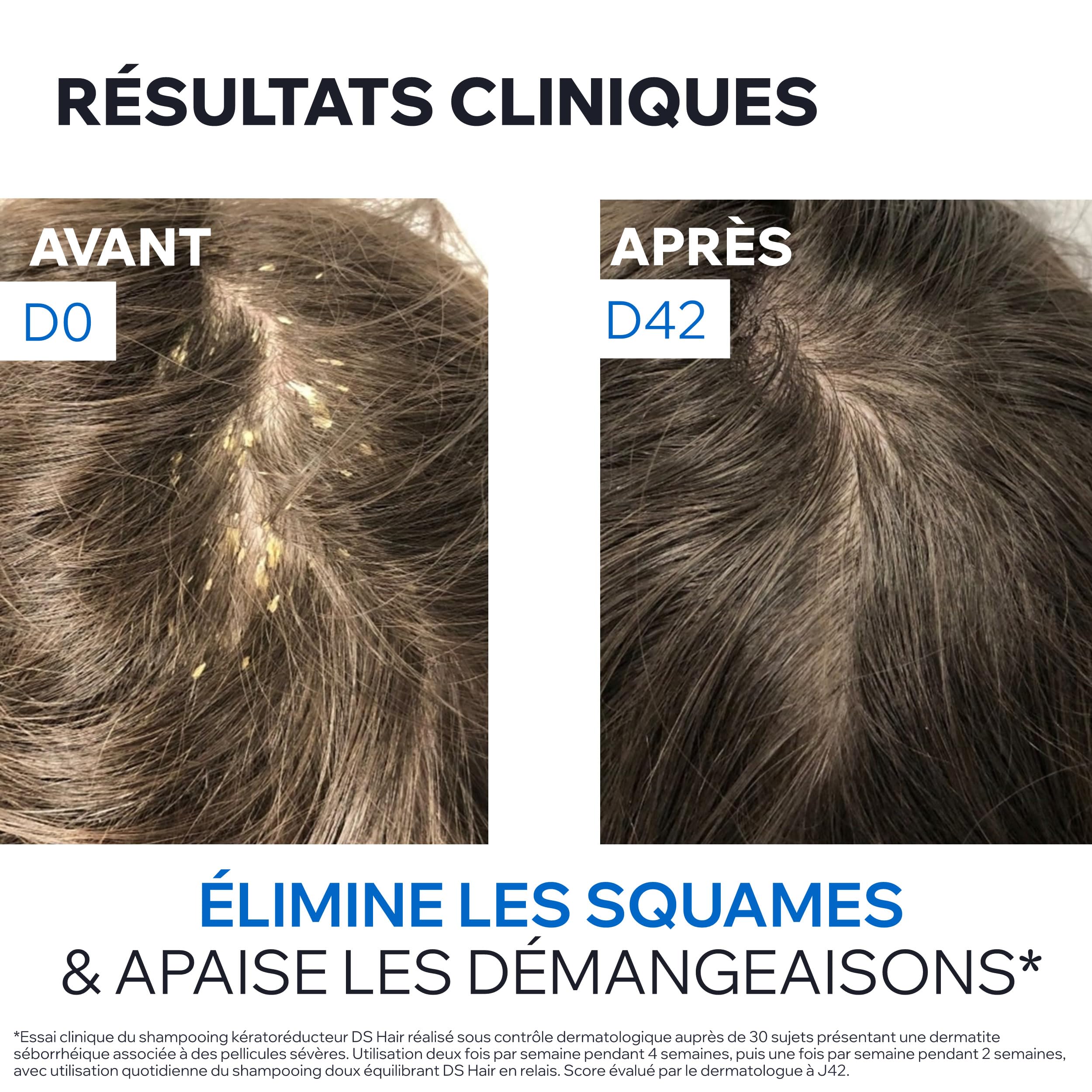 uriage-ds-hair-shampooing-traitant-k-rator-ducteur-150-ml image 6
